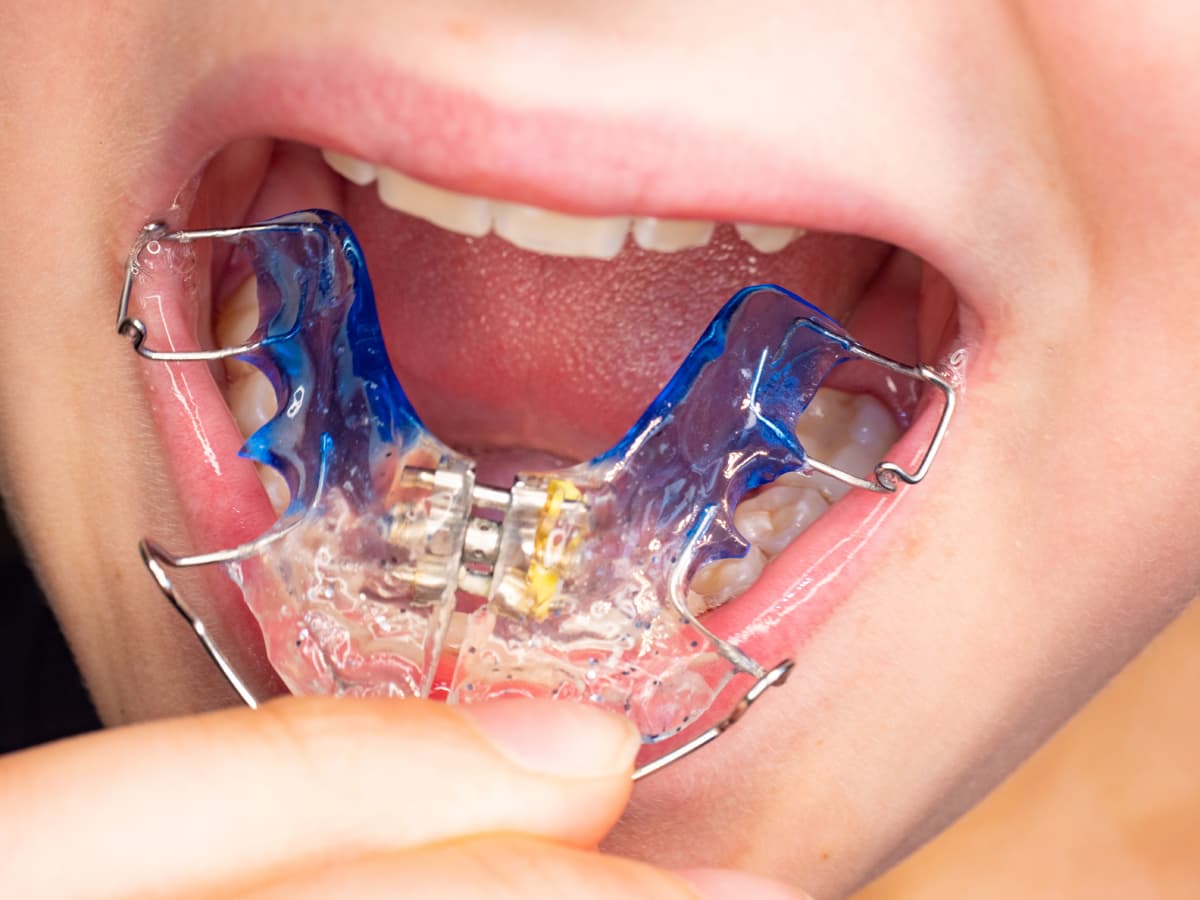 Clínica dental Val Miñor en Nigrán