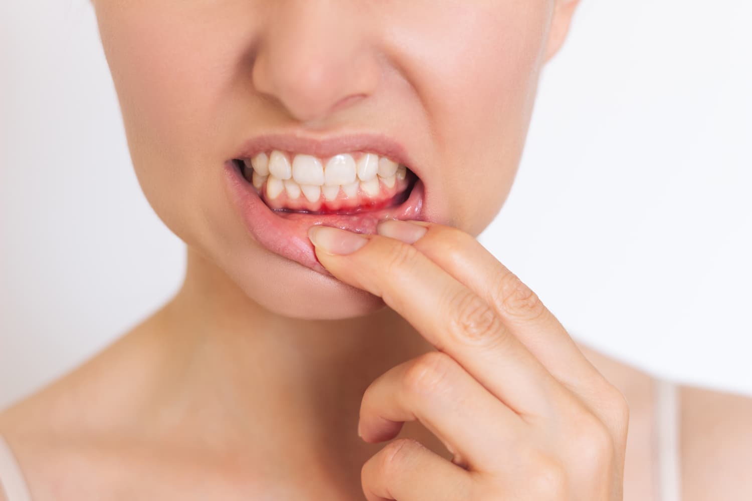Periodoncia en Nigrán